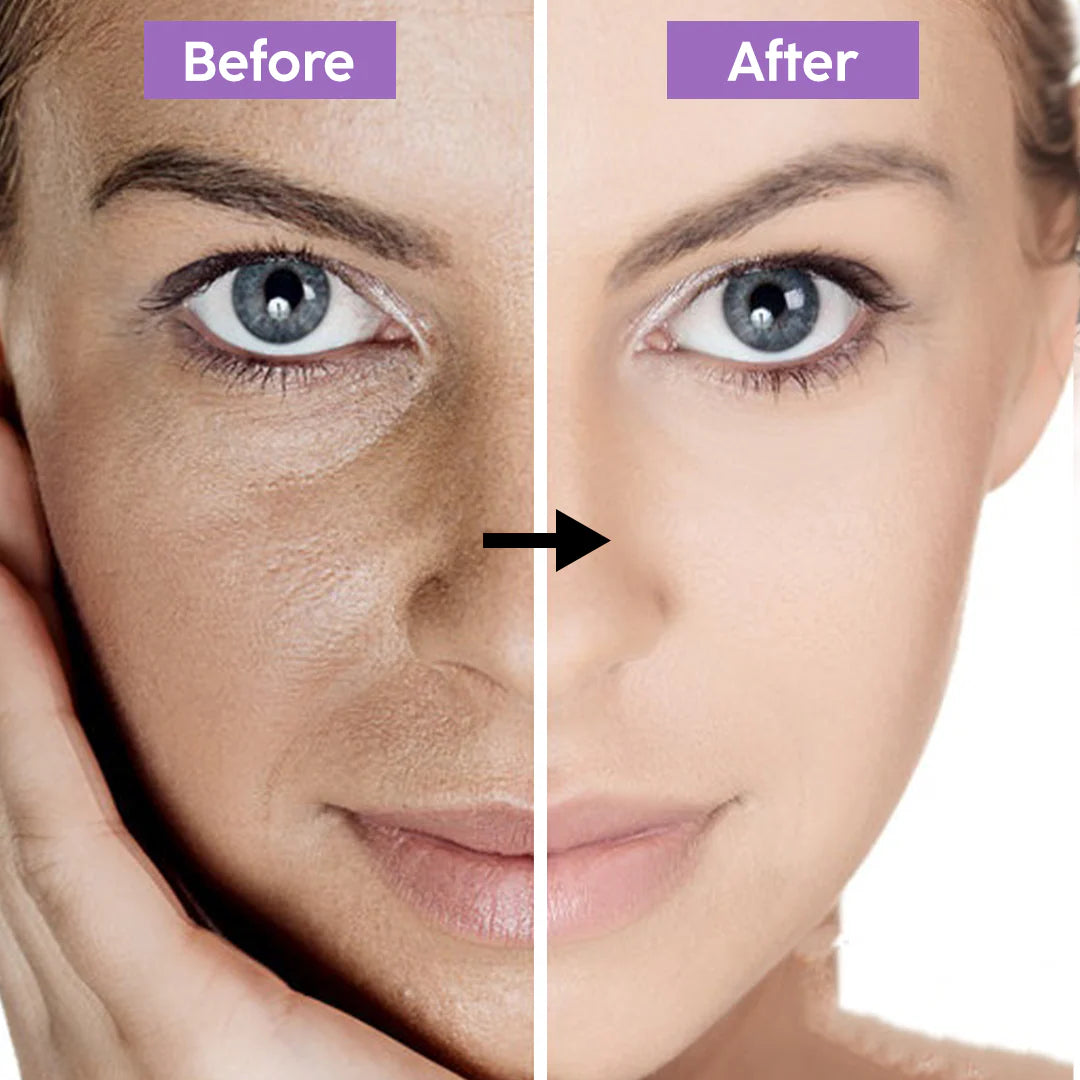 Glutathione Radiance Serum β 30ml | Skin Brightening, Anti-Acne & Blemish Control