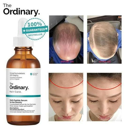 Multi-Peptide Volume Boost Hair Serum – 60ml | Thicker, Fuller & Healthier-Looking Hair